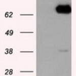 Anti-LTA4H (Leukotriene A4 hydrolase) monoclonal antibody
