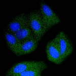 SRC Recombinant Rabbit Monoclonal Antibody (ST05-03)