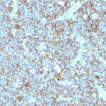 CD99 / MIC2 (Ewing's Sarcoma Marker) Antibody - With BSA and Azide