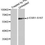 Anti Phospho ESR1 S167 Antibody