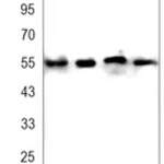 DFNA5 Rabbit monoclonal antibody