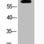 Acetyl-RELA (K221) Antibody