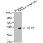 TP53 (pT18) Antibody