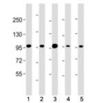 Beta Catenin Antibody (C-Terminal Region) [clone 691CT11.2.1] (F54099)
