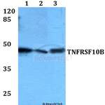 TNFRSF10B polyclonal antibody
