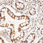 LTA4H Recombinant Rabbit Monoclonal Antibody (JE52-14)