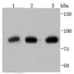 Glucocorticoid Receptor Recombinant Rabbit Monoclonal Antibody (JF0952)