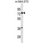 ESR1 Isoform1 (ESR1) Antibody