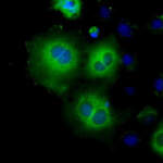 HK2 Monoclonal Antibody (OTI4C5), TrueMAB™
