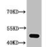 Acetyl-TP53 (K372) Antibody