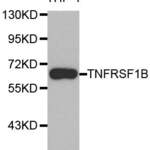TNFRSF1B Polyclonal Antibody