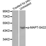 Anti Phospho MAPT S422 Antibody