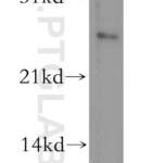 DLX1 Polyclonal antibody