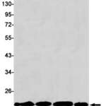 Recombinant RKIP Monoclonal Antibody