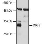 ING5 polyclonal antibody