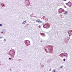 RELA / NFKB p65 Antibody (phospho-Ser529)